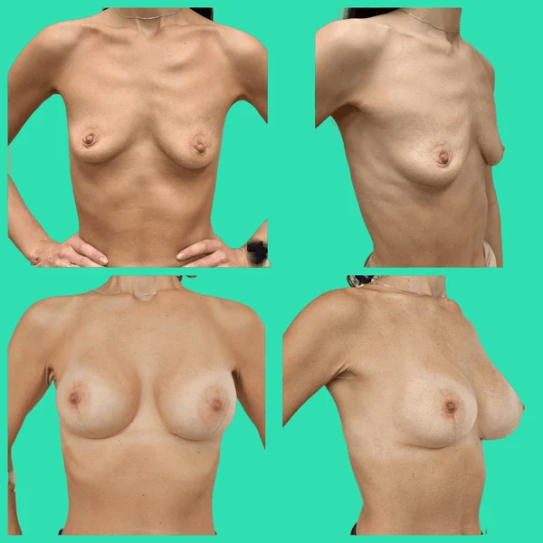 image-3